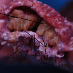 starfish_dissection2